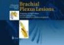 Brachial Plexus Lesions: Drawings of Explorations and Reconstructions -- Bok 9783540634287