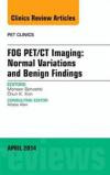 FDG PET/CT Imaging: Normal Variations and Benign Findings - Translation to PET/MRI, An Issue of PET Clinics, 1e (The Clinics: Radiology)