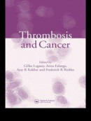 Thrombosis and Cancer -- Bok 9781135411909