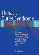 Thoracic Outlet Syndrome -- Bok 9781447171553