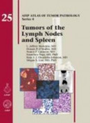 Tumors of the Lymph Node and Spleen -- Bok 9781933477381