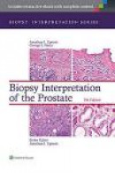Biopsy Interpretation of the Prostate -- Bok 9781451186741