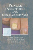 Fungal Infections of the Skin and Nails -- Bok 9781000105759