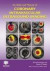 An Atlas and Manual of Coronary Intravascular Ultrasound Imaging -- Bok 9781842142745