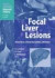 Focal Liver Lesions -- Bok 9783642084140