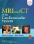 MRI and CT of the Cardiovascular System -- Bok 9781451137316