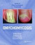 Onychomycosis -- Bok 9780415385794