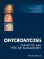Onychomycosis -- Bok 9781119226505