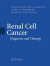 Renal Cell Cancer -- Bok 9781846287633