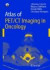 Atlas of PET/CT Imaging in Oncology -- Bok 9783642621413