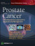 Prostate Cancer -- Bok 9781617051067