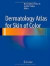 Dermatology Atlas for Skin of Color -- Bok 9783642544453