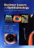 Excimer Lasers in Ophthalmology -- Bok 9781853172533