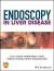 Endoscopy in Liver Disease -- Bok 9781118660850