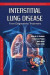 Interstitial Lung Disease -- Bok 9781685079260