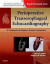Perioperative Transesophageal Echocardiography -- Bok 9781455707614