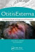 Otitis Externa -- Bok 9781482224573