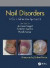 Nail Disorders -- Bok 9780815378341