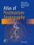 Atlas of Postmortem Angiography -- Bok 9783319285351