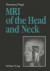 MRI of the Head and Neck -- Bok 9783642767920