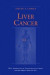 Liver Cancer -- Bok 9781461216667