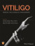 Vitiligo -- Bok 9781118937419