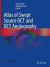 Atlas of Swept Source OCT and OCT Angiography -- Bok 9789811943904