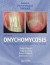 Onychomycosis -- Bok 9781032477862