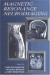 Magnetic Resonance Neuroimaging -- Bok 9780849347191