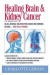 Healing Brain and Kidney Cancer - The Gerson Way -- Bok 9781937920012