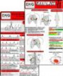 EKG Basic Set (2er Set) - Herzrhythmusstörungen, EKG Auswertung - Medizinische Taschen-Karte