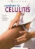 Combatir la celulitis/ Cellulite Fighting