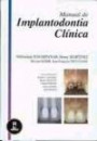 Manual De Implantodontia Clinica
