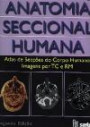 Anatomia Seccional Humana : Atlas de Seccoes do Corpo Humano, Imagens tc e rm