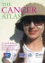 The Cancer Atlas: Spanish Language