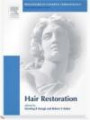 Procedures in Cosmetic Dermatology Series: Hair Transplantation: Textbook with DVD (Procedures in Cosmetic Dermatology)