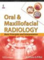 Oral and Maxillofacial Radiology: Basic Principles and Interpretation