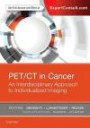 PET/CT in Cancer: An Interdisciplinary Approach to Individualized Imaging, 1e