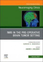 fMRI in the Pre-Operative Brain Tumor Setting, An Issue of Neuroimaging Clinics of North America, E-Book