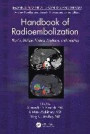 Handbook of Radioembolization: Physics, Biology, Nuclear Medicine, and Imaging (Imaging in Medical Diagnosis and Therapy)