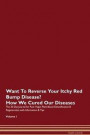 Want To Reverse Your Itchy Red Bump Disease? How We Cured Our Diseases. The 30 Day Journal For Raw Vegan Plant-Based Detoxification & Regeneration With Information & Tips Volume 1