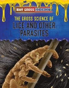 Gross Science of Lice and Other Parasites