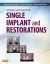 Principles and Practice of Single Implant and Restoration, 1e