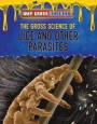 The Gross Science of Lice and Other Parasites