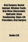 Oral Surgery: Dental Implant, Wisdom Tooth, Oral Ulcer, Bioceramic, Hydraulic Sinus Condensing, Sinus-Lift Procedure, Oral Surgery